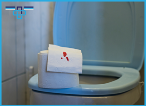 Αιμορραγία από το έντερο: Τι μπορεί να σημαίνει; 9