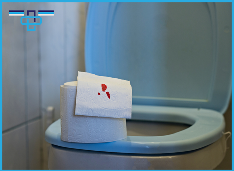 Αιμορραγία από το έντερο: Τι μπορεί να σημαίνει; 1