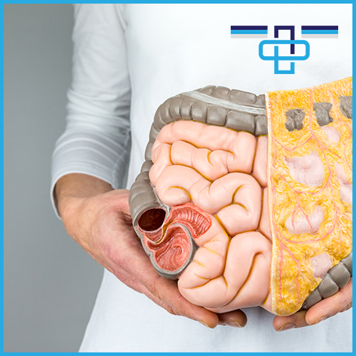 Καρκίνος του Παχέος Εντέρου 1