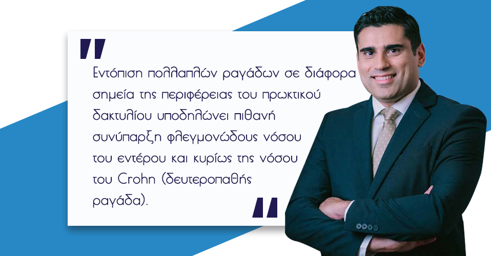 Ραγάδα Δακτυλίου