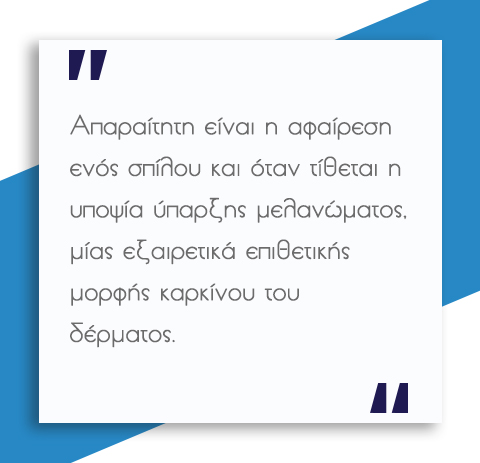 Σπίλοι - Πότε πρέπει να αφαιρούνται; 4 Σπίλοι - Πότε πρέπει να αφαιρούνται;