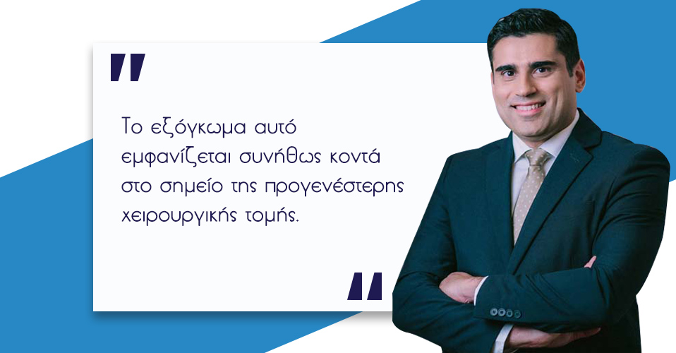 Μετεγχειρητική Κήλη: Τι είναι και Πώς προκαλείται; 2 Μετεγχειρητική Κήλη