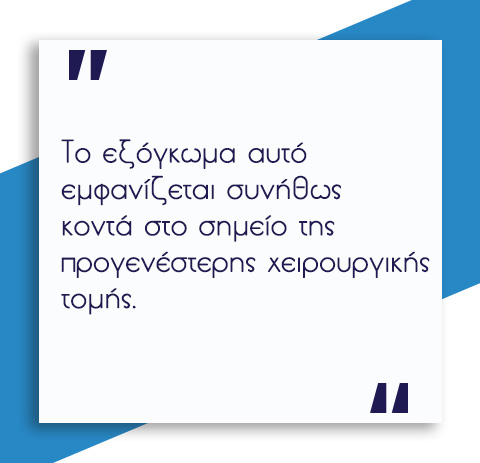 Μετεγχειρητική Κήλη: Τι είναι και Πώς προκαλείται; 3 Μετεγχειρητική Κήλη