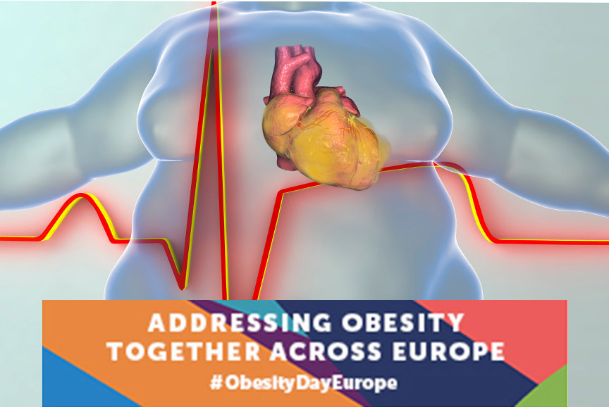 Παγκόσμια Ημέρα Παχυσαρκίας: Μία υποτιμημένη νόσος με επικίνδυνες διαστάσεις 1