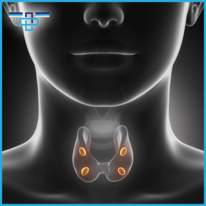 Τι είναι ο Υπερπαραθυρεοειδισμός και πώς αντιμετωπίζεται; 1