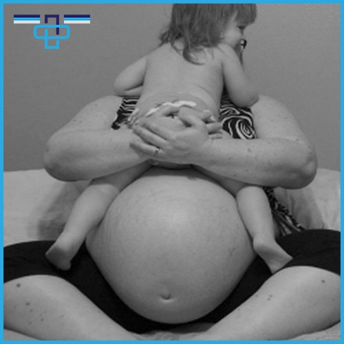 Πώς επηρεάζει η παχυσαρκία τη σύλληψη και την εγκυμοσύνη; 1