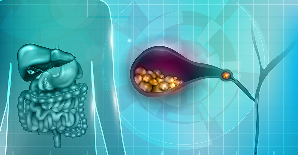 Πέτρες στη χολή 1