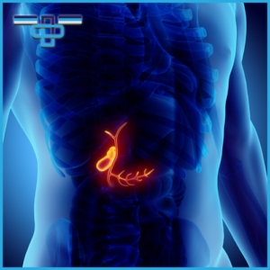 Πολύποδες χοληδόχου κύστης: Συμπτώματα και τρόποι αντιμετώπισης 5