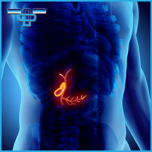 Πολύποδες χοληδόχου κύστης: Συμπτώματα και τρόποι αντιμετώπισης 1