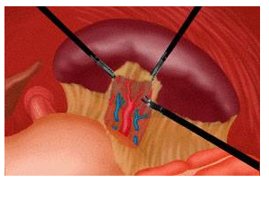 Παθήσεις Σπληνός