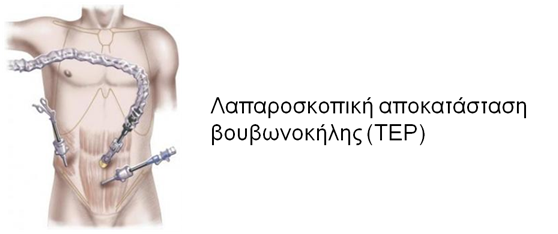 Χειρουργική Κηλών