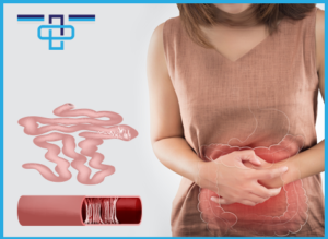 Συμφυτικός ειλεός λεπτού εντέρου: λαπαροσκοπική αντιμετώπιση (συμφυσιόλυση) 15