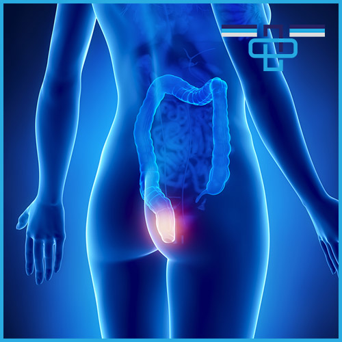 Αιμορροΐδες: Η συχνή και ενοχλητική νόσος 1