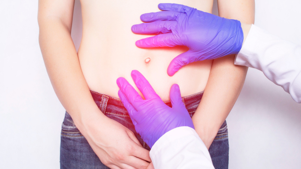 Πότε πρέπει να χειρουργηθεί μία κήλη ; 1