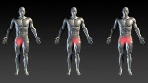 Βουβωνική χώρα 11