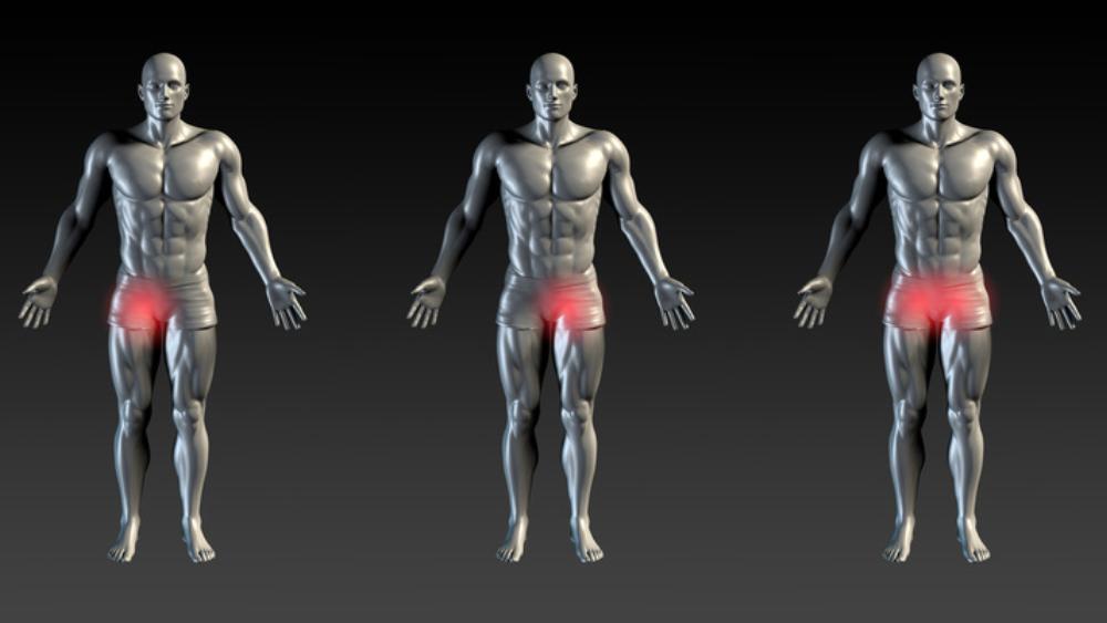 Βουβωνική χώρα 1