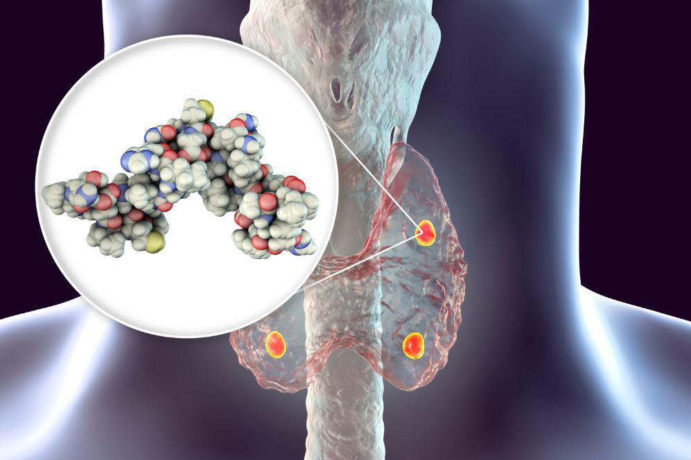 Υπερπαραθυρεοειδισμός 1