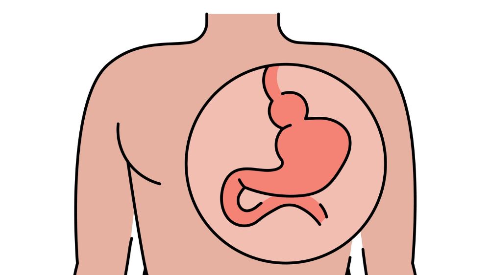 Υποτροπή διαφραγματοκήλης 1