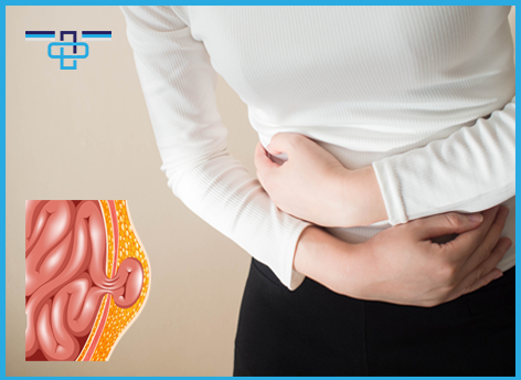 Χειρουργήθηκα για κήλη και υποτροπίασε. Γιατί; 1