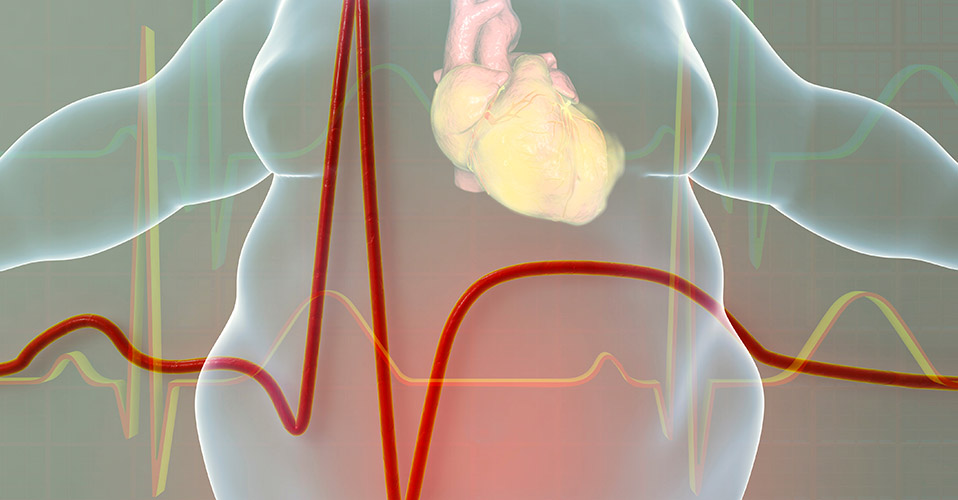 Χειρουργική Παχυσαρκίας 1 παχυσαρκία