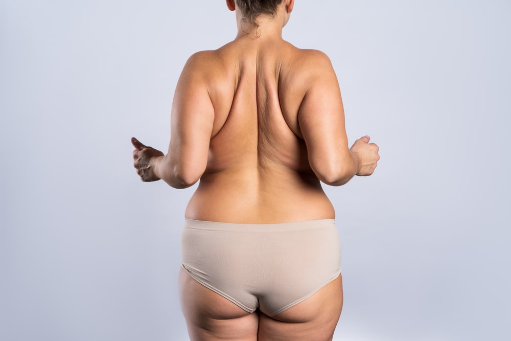 Ρομποτική χειρουργική θεραπεία της παχυσαρκίας 1