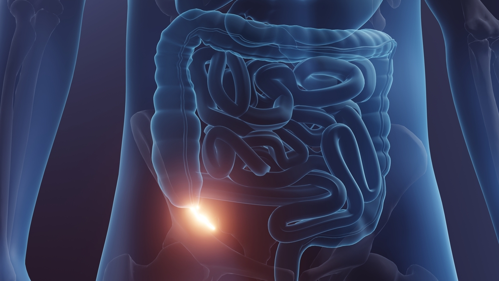 Σκωληκοειδίτιδα, τα πρώτα συμπτώματα 1