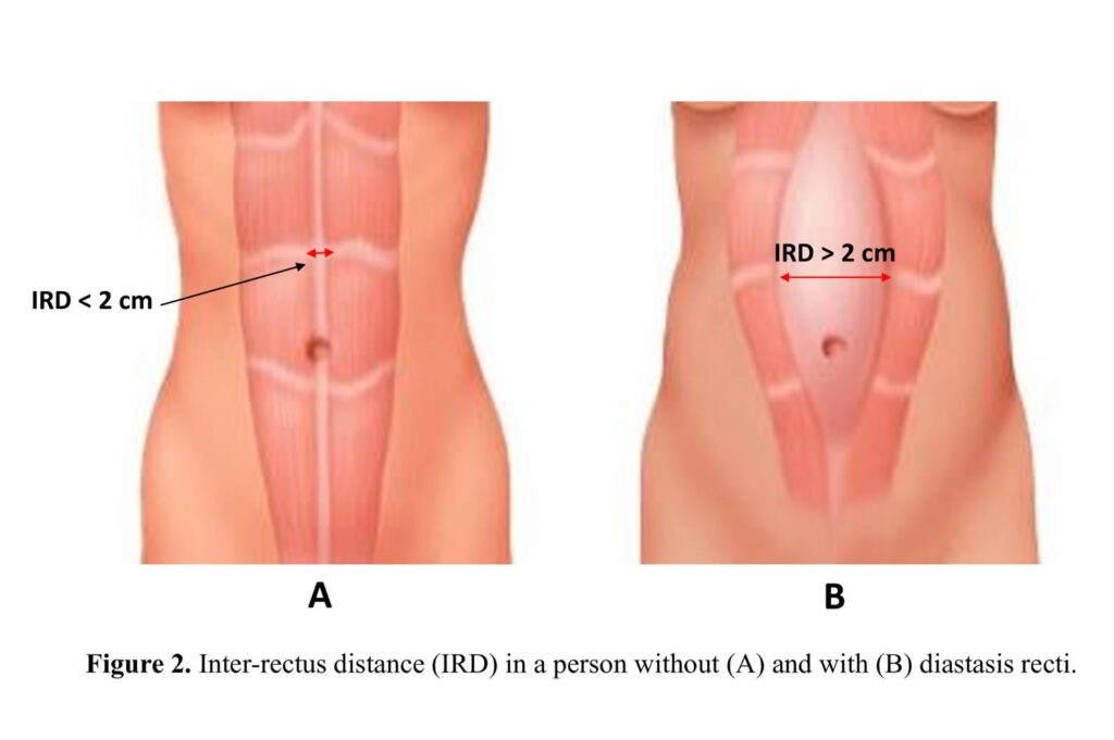 Διάσταση λευκής γραμμής